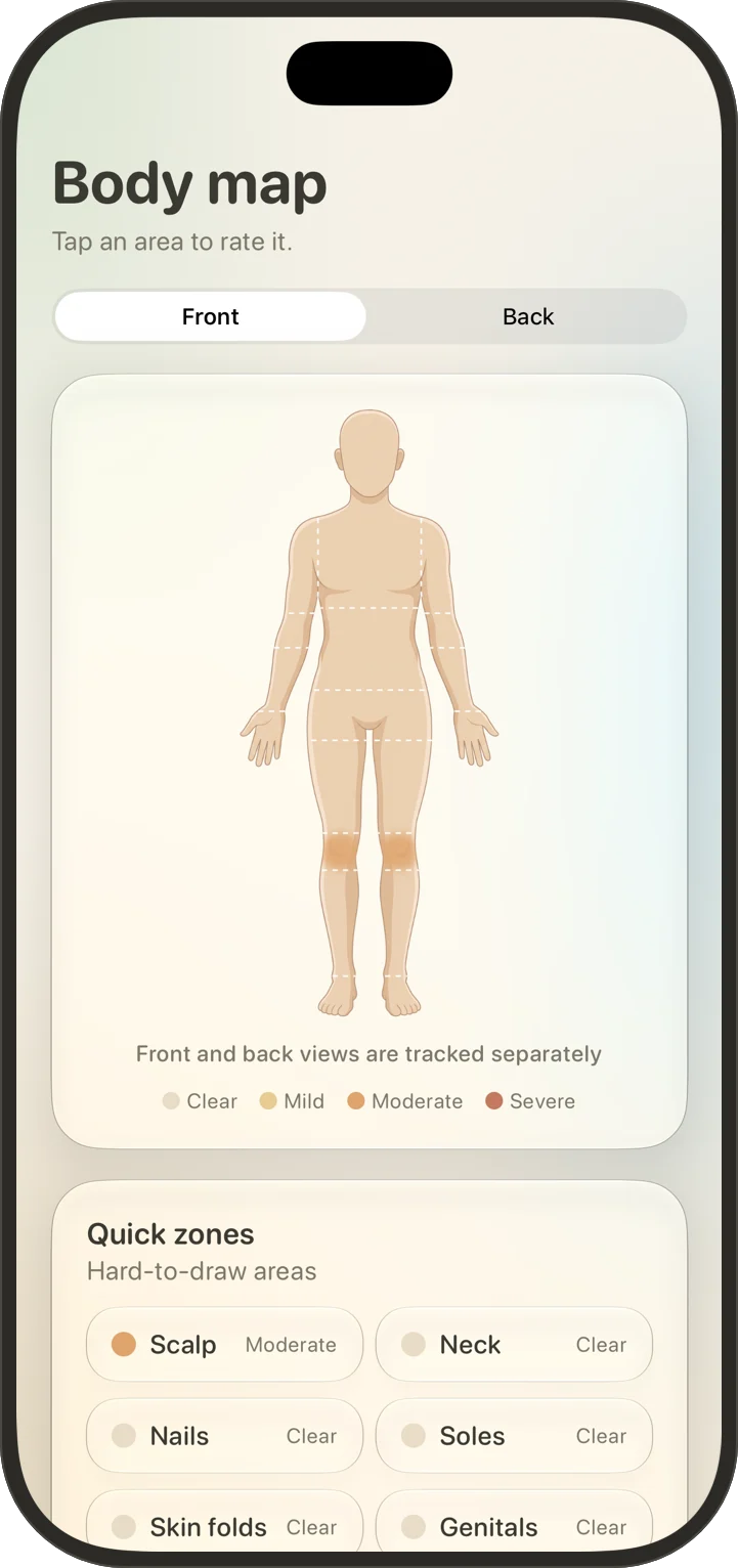 Body map with a front-view silhouette, dotted areas and a Clear, Mild, Moderate, Severe legend.