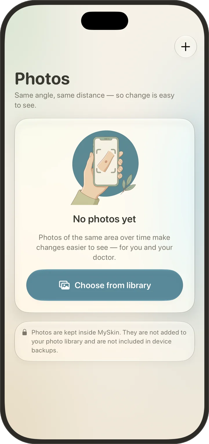Photos screen: photos are kept inside MySkin, not added to the photo library and not included in device backups.