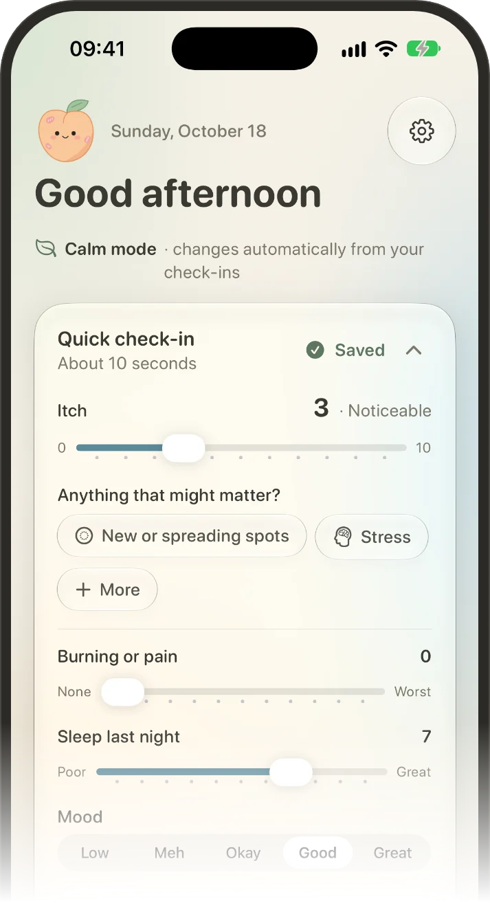 Screenshot of a daily check-in in the Velvi app with an itch slider, trigger buttons such as stress, and a sleep rating